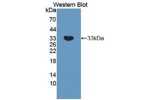 Detection of Recombinant PLCb2, Mouse using Polyclonal Antibody to Phospholipase C Beta 2 (PLCb2) (Phospholipase C beta 2 antibody  (AA 1-250))
