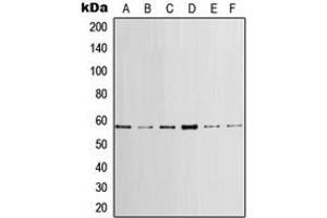Western blot analysis of LCK expression in HeLa (A), MCF7 (B), mouse brain (C), mouse heart (D), rat brain (E), rat heart (F) whole cell lysates. (LCK antibody  (Center))