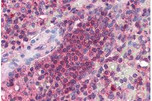 Human Spleen (formalin-fixed, paraffin-embedded) stained with ARMETL1 antibody ABIN351454 at 5 ug/ml followed by biotinylated goat anti-rabbit IgG secondary antibody ABIN481713, alkaline phosphatase-streptavidin and chromogen. (CDNF antibody  (C-Term))