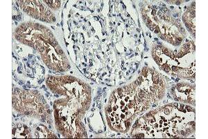 Image no. 1 for anti-butyrobetaine (Gamma), 2-Oxoglutarate Dioxygenase (Gamma-butyrobetaine Hydroxylase) 1 (BBOX1) antibody (ABIN1496815) (BBOX1 antibody)