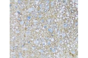 Immunohistochemistry of paraffin-embedded Rat brain using ATP1B2 Polyclonal Antibody at dilution of 1:100 (40x lens). (ATP1B2 antibody)