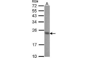 WB Image Sample (30 ug of whole cell lysate) A: A431 , 12% SDS PAGE CIB1 antibody antibody diluted at 1:1000 (CIB1 antibody)