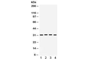 Western blot testing of 1) rat brain, 2) rat heart, 3) mouse heart and 4) human 22RV1 lysate with KChIP2 antibody. (KCNIP2 antibody)