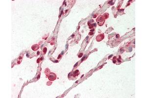 anti-Fanconi Anemia, Complementation Group C (FANCC) (AA 1-100) antibody