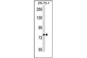 Western blot analysis of SIM1 Antibody (N-term) in ZR-75-1 cell line lysates (35ug/lane). (SIM1 antibody  (N-Term))