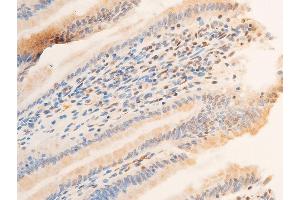 ABIN6256329 and ABIN6267218 at 1/100 staining rat intestinal tissue sections by IHC-P. (SGK1 antibody  (pSer422))