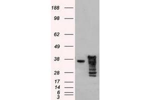 Image no. 1 for anti-DNA Fragmentation Factor, 45kDa, alpha Polypeptide (DFFA) antibody (ABIN1498773) (DFFA antibody)