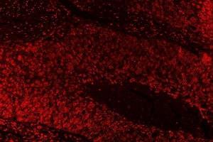 IF analysis of SAE1 using anti-SAE1 antibody (ABIN7601346). (SAE1 antibody  (AA 33-299))