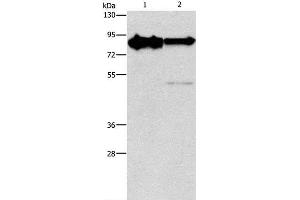 Western Blot analysis of Mouse brain and Human brain malignant glioma tissue using KIF3A Polyclonal Antibody at dilution of 1:750
