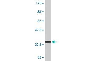 Western Blot detection against Immunogen (35. (TPD52 antibody  (AA 100-184))