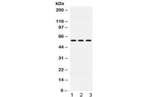 Western blot testing of 1) rat liver, 2) mouse HEPA and 3) human HeLa lysate with ALDH7A1 antibody at 0. (ALDH7A1 antibody  (AA 333-369))