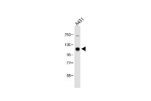 Anti-DDR1 Antibody (Center) at 1:500 dilution + A431 whole cell lysate Lysates/proteins at 20 μg per lane. (DDR1 antibody  (AA 299-330))