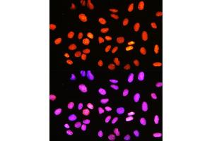 Immunofluorescence analysis of U-2 OS cells using DNA topoisomerase I (DNA topoisomerase I (TOP1)) Rabbit mAb (ABIN7270850) at dilution of 1:100 (40x lens). (Topoisomerase I antibody)