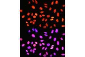 Immunofluorescence analysis of U-2 OS cells using DNA topoisomerase I (DNA topoisomerase I (TOP1)) Rabbit mAb (ABIN7270850) at dilution of 1:100 (40x lens). (Topoisomerase I antibody)