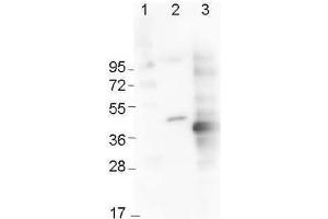 Western Blot using  Immunochemical's Mouse Anti-6x-His Epitope Tag Monoclonal Antibody showing detection of the 6xHis sequence on N-terminally-tagged (lane 2) and C-terminally-tagged recombinant proteins (lane 3). (His Tag antibody)