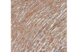 IHC analysis of Actin using anti-Actin antibody (ABIN3043519).