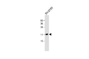 Anti-FGF1 Antibody (N-term) at 1:1000 dilution + SH-SY5Y whole cell lysate Lysates/proteins at 20 μg per lane. (FGF1 antibody  (N-Term))