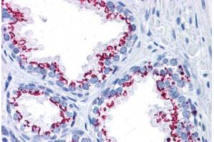 Human Prostate: Formalin-Fixed, Paraffin-Embedded (FFPE) (GOLM1 antibody  (AA 389-401))