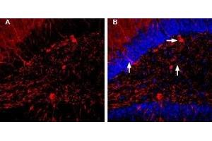 Expression of GABA(A) α1 Receptor in rat hippocampusImmunohistochemical staining of rat hippocampal dentate gyrus sections using Guinea pig Anti-GABA(A) α1 Receptor (extracellular) Antibody (ABIN7043185, ABIN7045422 and ABIN7045423).