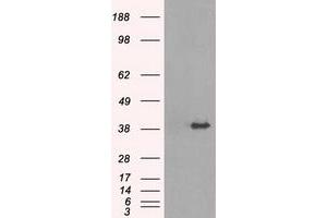 Image no. 1 for anti-Tribbles Pseudokinase 2 (TRIB2) antibody (ABIN1501501) (TRIB2 antibody)