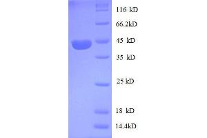 SDS-PAGE (SDS) image for Insulin-Like Growth Factor 2 (IGF2) (AA 30-180), (partial) protein (GST tag) (ABIN1047204) (IGF2 Protein (AA 30-180, partial) (GST tag))