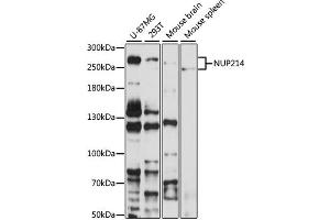Western blot analysis of extracts of various cell lines, using NUP214 antibody (ABIN6127536, ABIN6144958, ABIN6144959 and ABIN6224385) at 1:1000 dilution. (NUP214 antibody  (AA 750-1030))
