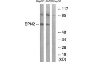 Western blot analysis of extracts from HepG2/HuvEc cells, using EPN2 Antibody.
