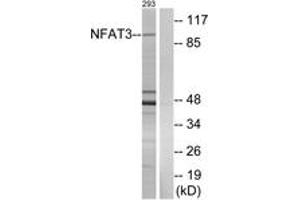 Western blot analysis of extracts from 293 cells, using NFAT3 (Ab-676) Antibody. (NFATC4 antibody  (AA 642-691))
