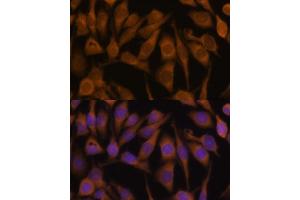 Immunofluorescence analysis of HeLa cells using UBQLN2 Polyclonal Antibody (ABIN6127815, ABIN6149859, ABIN6149860 and ABIN6225041) at dilution of 1:100 (40x lens).
