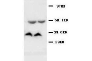 Western blot analysis of rat kidney tissue lysis using SAMDC antibody