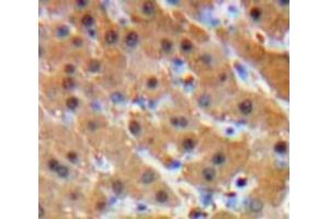 IHC-P analysis of Liver tissue, with DAB staining. (Glucocorticoid Receptor antibody  (AA 564-733))
