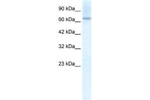 WB Suggested Anti-PIAS2 Antibody Titration:  2. (PIAS2 antibody  (C-Term))