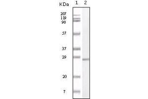 Western Blot showing S100A antibody used against truncated S100A recombinant protein. (S100A1 antibody)