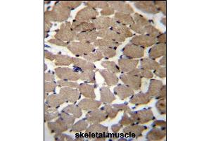 Immunohistochemistry (Paraffin-embedded Sections) (IHC (p)) image for anti-Mannosyl (Alpha-1,3-)-Glycoprotein beta-1,4-N-Acetylglucosaminyltransferase, Isozyme C (MGAT4C) (AA 303-332), (C-Term) antibody (ABIN656550)