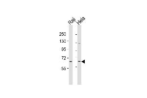 All lanes : Anti-MLLT1 Antibody  at 1:2000 dilution Lane 1: Raji whole cell lysates Lane 2: Hela whole cell lysates Lysates/proteins at 20 μg per lane. (MLLT1 antibody  (C-Term))