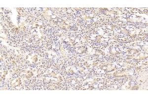 Detection of PRAME in Human Small intestine Tissue using Polyclonal Antibody to Preferentially Expressed Antigen In Melanoma (PRAME) (PRAME antibody  (AA 416-502))