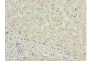 Immunohistochemistry of paraffin-embedded human liver tissue using ABIN7169532 at dilution of 1:100 (DHRS3 antibody  (AA 30-169))
