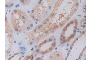 Detection of TNFSF9 in Human Kidney Tissue using Polyclonal Antibody to Tumor Necrosis Factor Ligand Superfamily, Member 9 (TNFSF9) (TNFSF9 antibody  (AA 42-253))