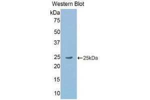 Western Blotting (WB) image for anti-Gastrokine 2 (GKN2) (AA 21-184) antibody (ABIN2117758) (Gastrokine 2 antibody  (AA 21-184))