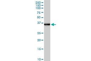 FCN2 MaxPab rabbit polyclonal antibody. (Ficolin 2 antibody  (AA 1-313))