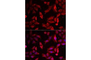 Immunofluorescence analysis of HeLa cells using SERPINB9 antibody. (SERPINB9 antibody  (AA 1-376))