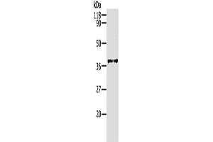 Western Blotting (WB) image for anti-Aldo-Keto Reductase Family 1, Member B1 (Aldose Reductase) (AKR1B1) antibody (ABIN2427538) (AKR1B1 antibody)