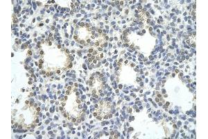 Rabbit Anti-ZNF264 antibody         Paraffin Embedded Tissue:  Human Lung    cell Cellular Data:  alveolar cell    Antibody Concentration:  4. (ZNF264 antibody  (N-Term))