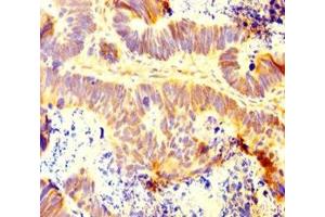 Immunohistochemistry (IHC) image for anti-Integrator Complex Subunit 9 (INTS9) (AA 368-658) antibody (ABIN7156421)