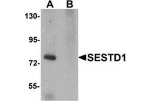 Western blot analysis of SESTD1 in rat brain tissue lysate with SESTD1 antibody at 1 μg/ml in (A) the absence and (B) the presence of blocking peptide. (SESTD1 antibody  (C-Term))