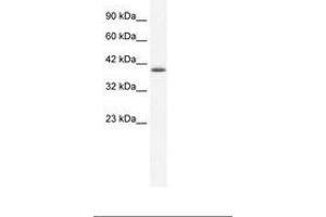 Image no. 1 for anti-Zinc Finger Protein 365 (ZNF365) (AA 33-82) antibody (ABIN202270) (ZNF365 antibody  (AA 33-82))