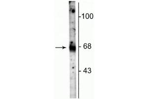 Western blot of rat hippocampal lysate showing specific immunolabeling of the ~67 kDa GAT-1 protein. (SLC6A1 antibody  (C-Term))