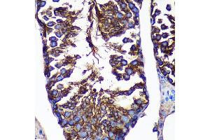 Immunohistochemistry of paraffin-embedded Mouse testis using CTNN Rabbit pAb (ABIN7266136) at dilution of 1:100 (40x lens). (CTNNA3 antibody  (AA 1-240))