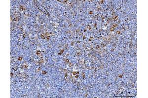 IHC analysis of Axin 2/AXIN2 using anti-Axin 2/AXIN2 antibody (ABIN7602177).
