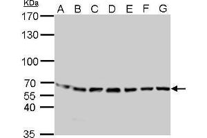WB Image STIP1 antibody detects STIP1 protein by Western blot analysis.